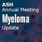 ASH 2014 Multiple Myeloma Update – Day One: Poster Session