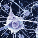 Neurological Monitoring May Help Reduce Velcade-Induced Nerve Damage In Multiple Myeloma Patients