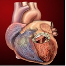 Stem Cell Transplants May Increase Risk Of Heart Disease