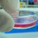 Gene Therapy To Treat Leukemia And Multiple Myeloma: An Update