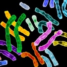 Chromosomal Abnormalities And Tumor Load Linked To More Rapid Progression In Smoldering Myeloma Patients