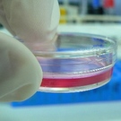 Macrophages May Contribute To Survival Of Multiple Myeloma Cells