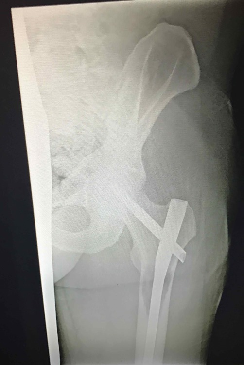 femur-cropped-small.jpg
